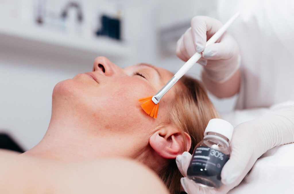 Put prema mirnoj koži: zašto akne traže strpljenje, a ne instant rješenja