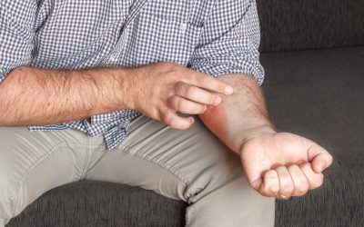 Da li psorijaza svrbi kod svih tipova bolesti?