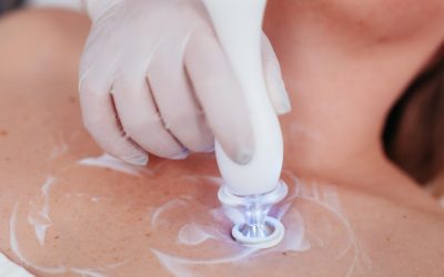 Prirodan izgled bez pretjerivanja: zašto sve više žena bira pametan anti age pristup